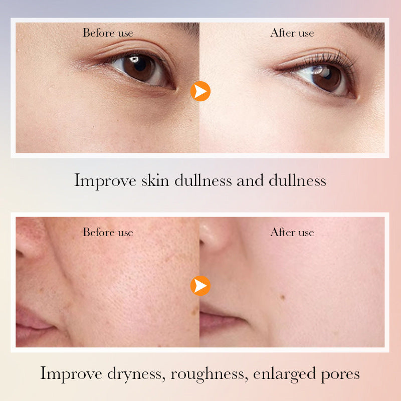 SADOER Vitamin C Skincare Whitening Set